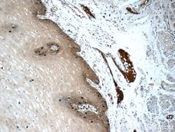 CLCA2 Rabbit anti-Human, Mouse, Polyclonal, Proteintech 150 &mu;L; Unconjugated:Antibodies,