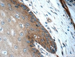 CLCA2 Rabbit anti-Human, Mouse, Polyclonal, Proteintech 150 &mu;L; Unconjugated:Antibodies,