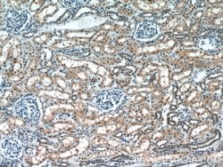 DNMT3A Rabbit anti-Human, Mouse, Rat, Polyclonal, Proteintech 150 &mu;L;