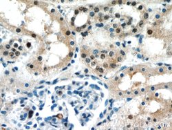 DNMT3A Rabbit anti-Human, Mouse, Rat, Polyclonal, Proteintech 150 &mu;L;