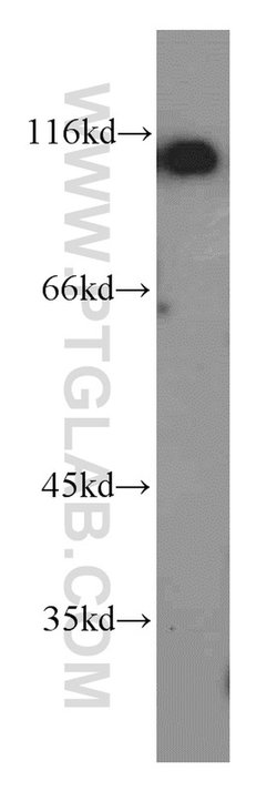 USP10 Rabbit anti-Human, Mouse, Rat, Polyclonal, Proteintech:  