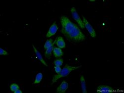 ABHD14A Rabbit anti-Human, Mouse, Rat, Polyclonal, Proteintech:Antibodies:Primary