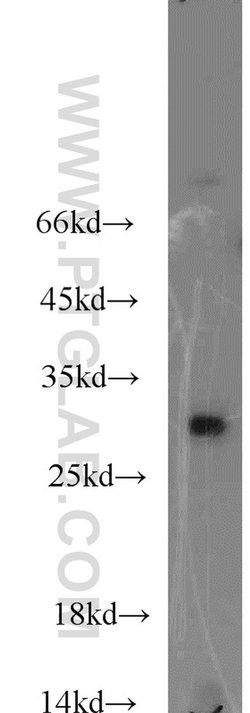 ABHD14A Rabbit anti-Human, Mouse, Rat, Polyclonal, Proteintech:Antibodies:Primary