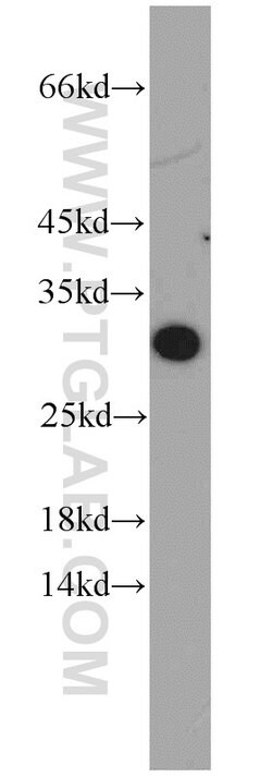 ABHD14A Rabbit anti-Human, Mouse, Rat, Polyclonal, Proteintech:Antibodies:Primary