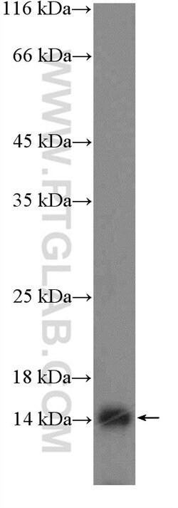 FAM103A1 Rabbit anti-Human, Mouse, Rat, Polyclonal, Proteintech:Antibodies:Primary
