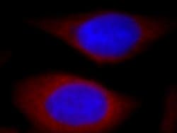 PIH1D1 Rabbit anti-Human, Mouse, Rat, Polyclonal, Proteintech:Antibodies:Primary