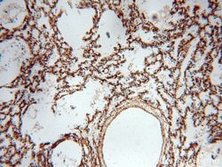PIH1D1 Rabbit anti-Human, Mouse, Rat, Polyclonal, Proteintech:Antibodies:Primary