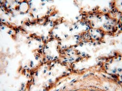PIH1D1 Rabbit anti-Human, Mouse, Rat, Polyclonal, Proteintech:Antibodies:Primary