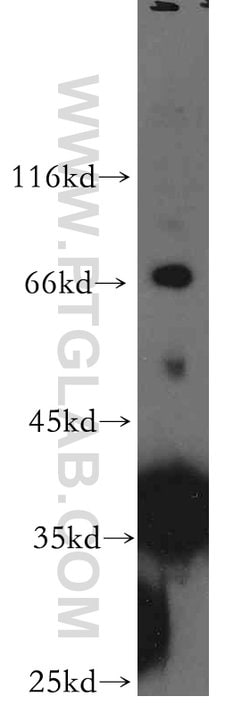 PIH1D1 Rabbit anti-Human, Mouse, Rat, Polyclonal, Proteintech:Antibodies:Primary