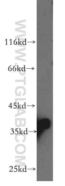PIH1D1 Rabbit anti-Human, Mouse, Rat, Polyclonal, Proteintech:Antibodies:Primary