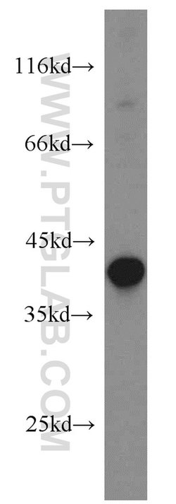 PIH1D1 Rabbit anti-Human, Mouse, Rat, Polyclonal, Proteintech:Antibodies:Primary