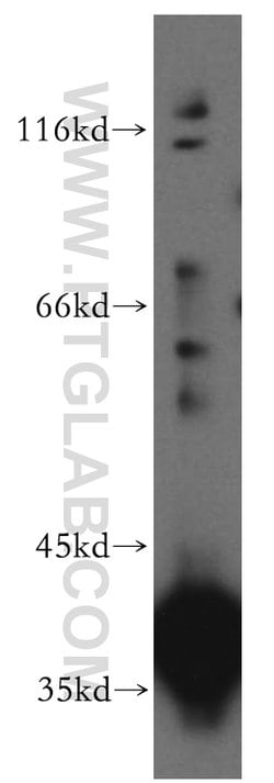 PIH1D1 Rabbit anti-Human, Mouse, Rat, Polyclonal, Proteintech:Antibodies:Primary