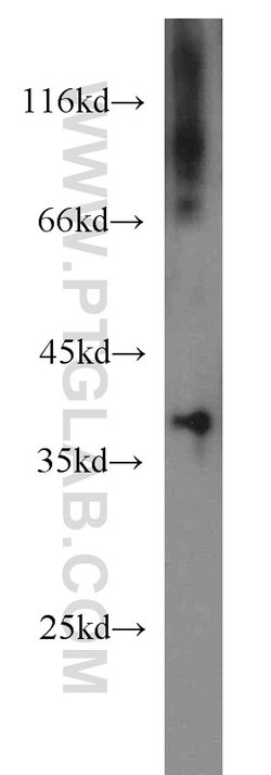 PIH1D1 Rabbit anti-Human, Mouse, Rat, Polyclonal, Proteintech:Antibodies:Primary