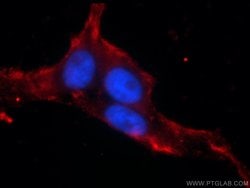 ANO8 Rabbit anti-Human, Mouse, Rat, Polyclonal, Proteintech:Antibodies:Primary