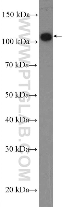 ANO7 Rabbit anti-Human, Polyclonal, Proteintech:Antibodies:Primary Antibodies