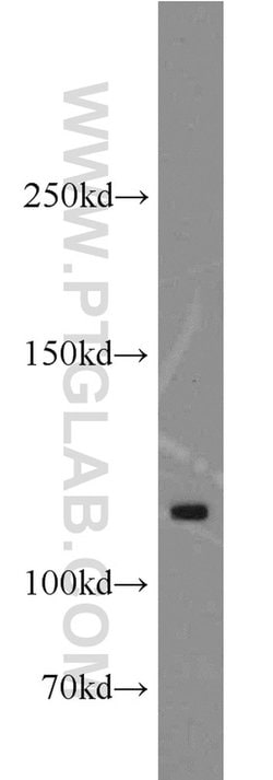 ANO3 Rabbit anti-Human, Mouse, Polyclonal, Proteintech 150 &mu;L; Unconjugated:Antibodies,
