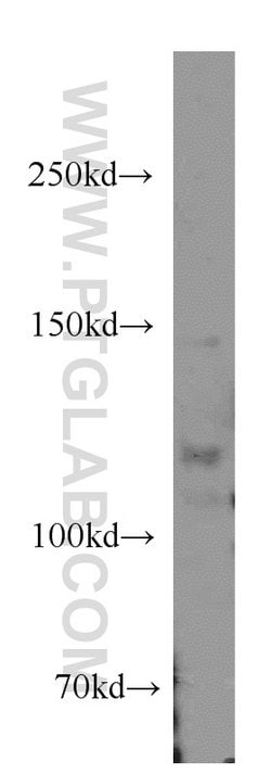 ANO3 Rabbit anti-Human, Mouse, Polyclonal, Proteintech 150 &mu;L; Unconjugated:Antibodies,