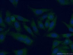 AFM Rabbit anti-Human, Polyclonal, Proteintech:Antibodies:Primary Antibodies