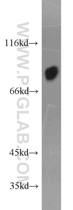 AFM Rabbit anti-Human, Polyclonal, Proteintech:Antibodies:Primary Antibodies