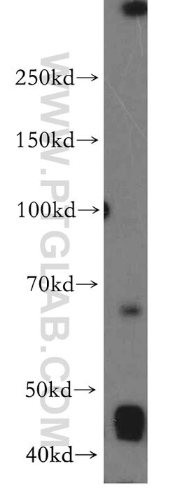 LRMP Rabbit anti-Human, Polyclonal, Proteintech 20 &mu;L; Unconjugated:Antibodies,
