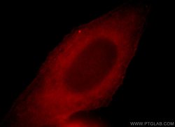 LRMP Rabbit anti-Human, Polyclonal, Proteintech 20 &mu;L; Unconjugated:Antibodies,
