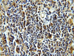 LRMP Rabbit anti-Human, Polyclonal, Proteintech 20 &mu;L; Unconjugated:Antibodies,