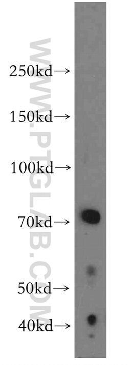 LRMP Rabbit anti-Human, Polyclonal, Proteintech 20 &mu;L; Unconjugated:Antibodies,