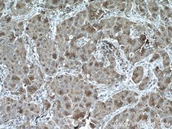 SULT1A3 Rabbit anti-Human, Mouse, Polyclonal, Proteintech:Antibodies:Primary