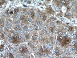 SULT1A3 Rabbit anti-Human, Mouse, Polyclonal, Proteintech:Antibodies:Primary