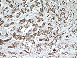 SULT1A3 Rabbit anti-Human, Mouse, Polyclonal, Proteintech:Antibodies:Primary