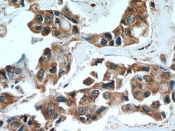SULT1A3 Rabbit anti-Human, Mouse, Polyclonal, Proteintech:Antibodies:Primary