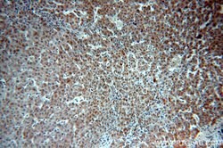 SULT1A3 Rabbit anti-Human, Mouse, Polyclonal, Proteintech:Antibodies:Primary