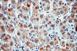 SULT1A3 Rabbit anti-Human, Mouse, Polyclonal, Proteintech:Antibodies:Primary