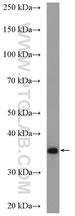 SULT1A3 Rabbit anti-Human, Mouse, Polyclonal, Proteintech:Antibodies:Primary