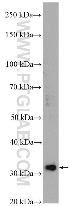 SULT1A3 Rabbit anti-Human, Mouse, Polyclonal, Proteintech:Antibodies:Primary