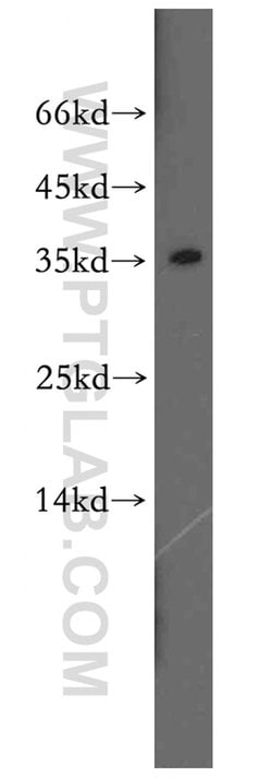 SULT1A3 Rabbit anti-Human, Mouse, Polyclonal, Proteintech:Antibodies:Primary