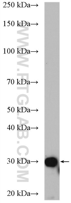 SULT1A3 Rabbit anti-Human, Mouse, Polyclonal, Proteintech:Antibodies:Primary