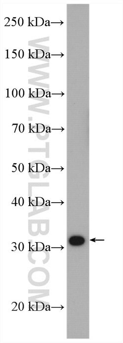 SULT1A3 Rabbit anti-Human, Mouse, Polyclonal, Proteintech:Antibodies:Primary