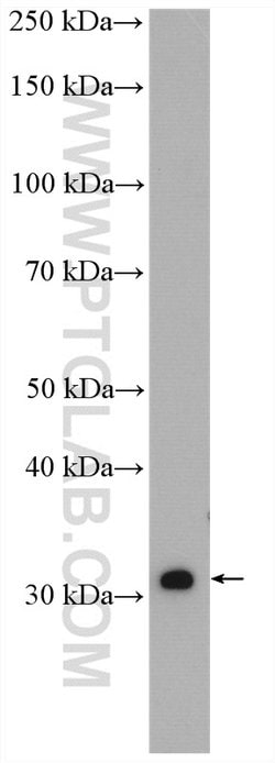 SULT1A3 Rabbit anti-Human, Mouse, Polyclonal, Proteintech:Antibodies:Primary