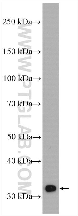 SULT1A3 Rabbit anti-Human, Mouse, Polyclonal, Proteintech:Antibodies:Primary