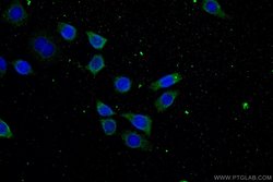 ATP9A Rabbit anti-Human, Mouse, Rat, Polyclonal, Proteintech 150 &mu;L | Buy Online | Proteintech Group Inc | Fisher Scientific