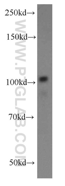 ATP9A Rabbit anti-Human, Mouse, Rat, Polyclonal, Proteintech 150 &mu;L | Buy Online | Proteintech Group Inc | Fisher Scientific