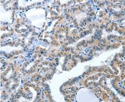 Angiotensin Converting Enzyme 2 (ACE2) Polyclonal Antibody, QED Bioscience