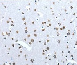 Angiotensin Converting Enzyme 2 (ACE2) Polyclonal Antibody, QED Bioscience