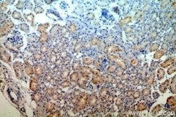 MAST3 Rabbit anti-Human, Mouse, Rat, Polyclonal, Proteintech 150 μL;