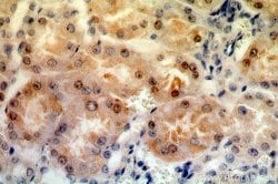 MAST3 Rabbit anti-Human, Mouse, Rat, Polyclonal, Proteintech 150 μL;