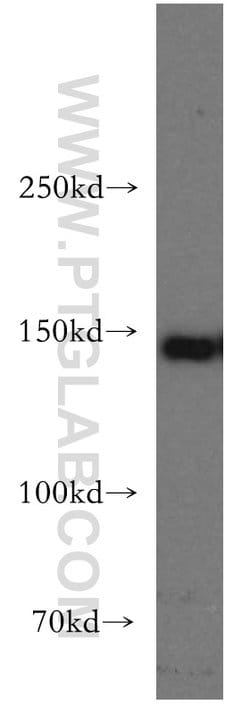 MAST3 Rabbit anti-Human, Mouse, Rat, Polyclonal, Proteintech 150 μL;