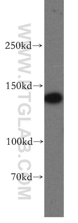 MAST3 Rabbit anti-Human, Mouse, Rat, Polyclonal, Proteintech 150 μL;