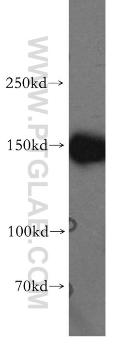 MAST3 Rabbit anti-Human, Mouse, Rat, Polyclonal, Proteintech 150 μL;