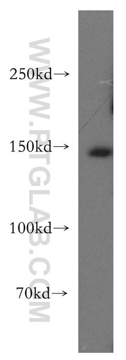 MAST3 Rabbit anti-Human, Mouse, Rat, Polyclonal, Proteintech 150 μL;